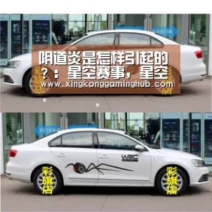 阴道炎是怎样引起的?:星空赛事,星空官网,星空电竞,星空竞猜(图2) 星空赛事,星空官网,星空电竞,星空竞猜